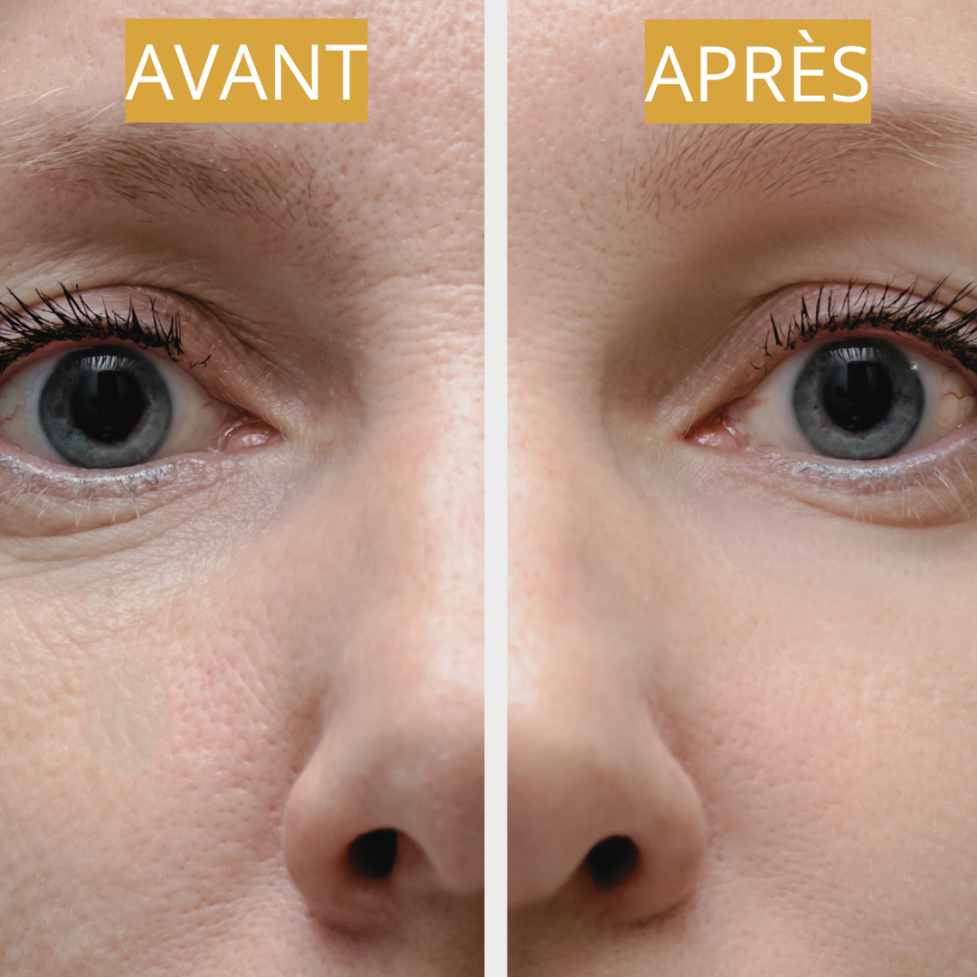 Comparaison visuelle du regard avant et après l’utilisation du masseur Belle après 40 ans