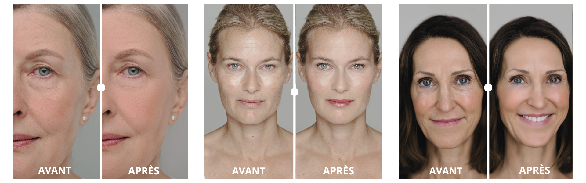 Transformation avant/après – teint plus lumineux et unifié dès 40 ans